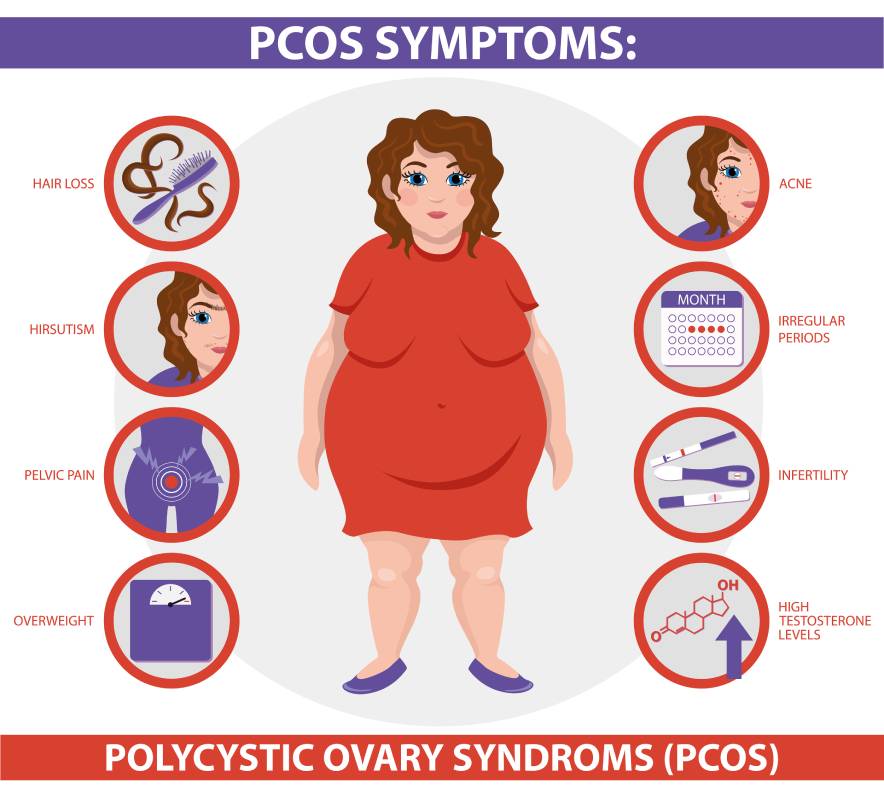 10 Ways PCOS Affects The Body