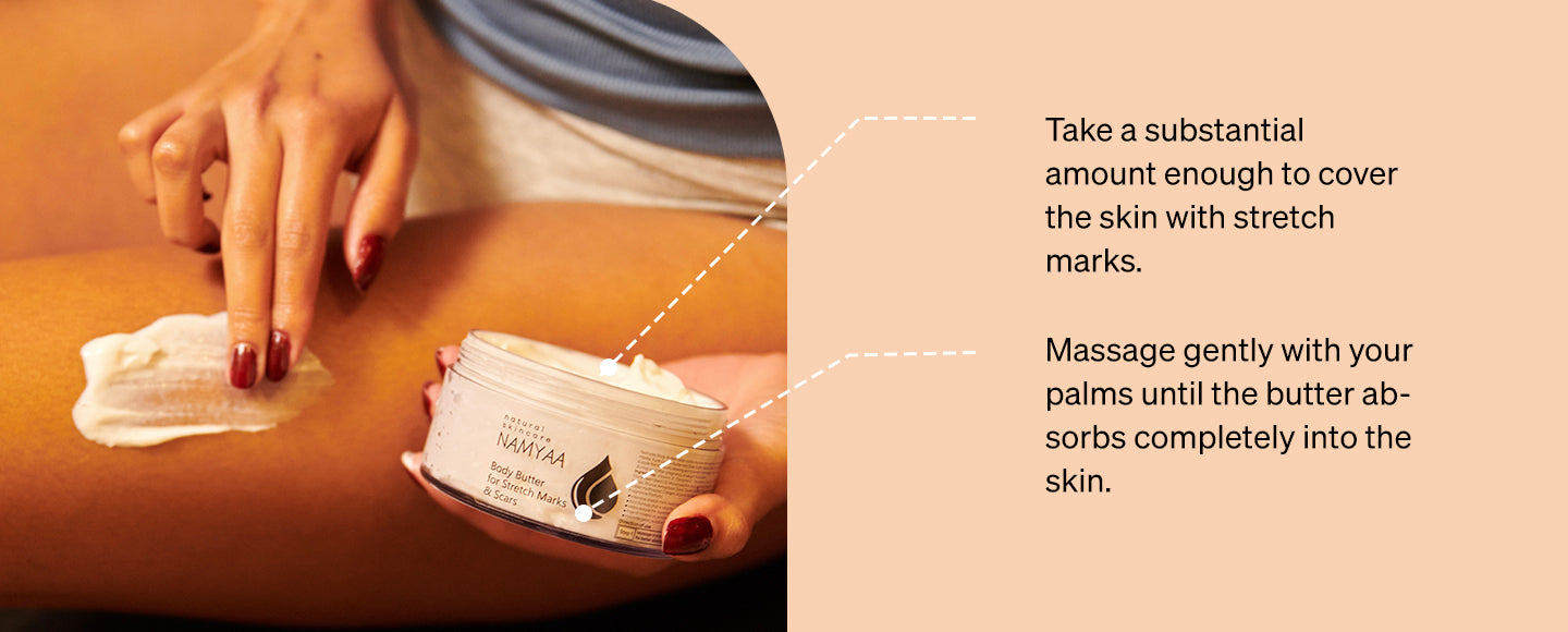 Body Butter for Stretch Marks & Scars