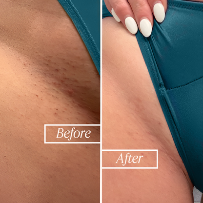 Intimate Lightening Serum