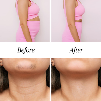 PCOD and PCOS Ayurvedic Kit